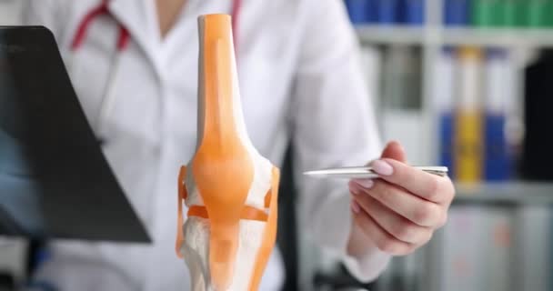 Traumatólogo Examinando Radiografía Mostrando Problema Modelo Anatómico Película Cerca Rodilla — Vídeo de stock