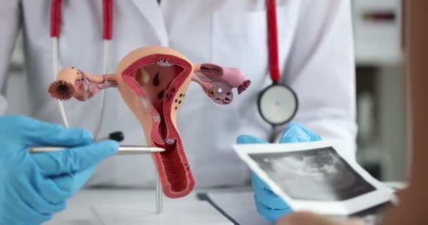 Doctor Points Pen Anatomical Model Female Reproductive System Pregnancy Planning — Video