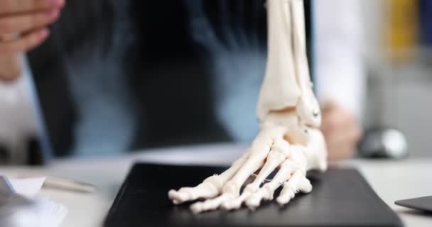 Anatomiczny Model Nogi Stole Zbliżenie Konsultacja Chirurgiem Traumatologiem — Wideo stockowe