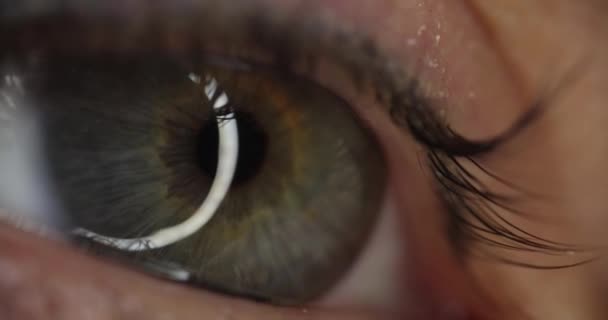 Női Szem Szürke Zöld Pupillával Száraz Szemhéj Bőr Bőrgyulladás Fogalma — Stock videók