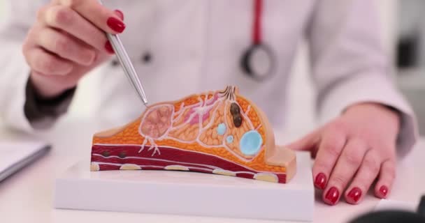 Meme Bezleri Hastalığını Anatomik Bir Göğüs Modeli Kullanarak Açıklayan Kadın — Stok video