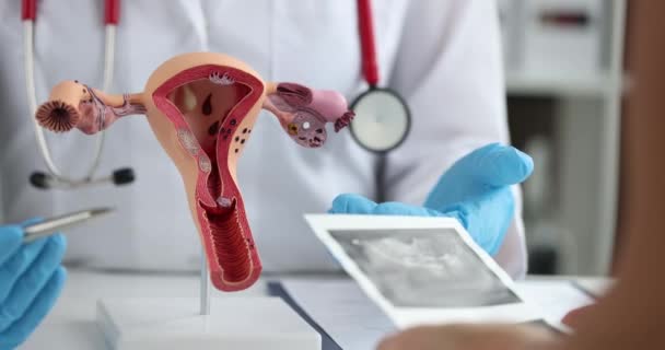 Anatomical Model Female Reproductive System Close Consultation Gynecologist Ultrasound Uterus — Stockvideo