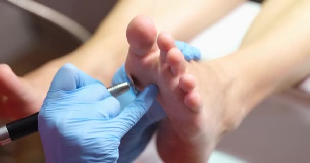 Pedicure Master Removes Corns Womans Legs Close Cosmetic Procedure Salon — стоковое видео