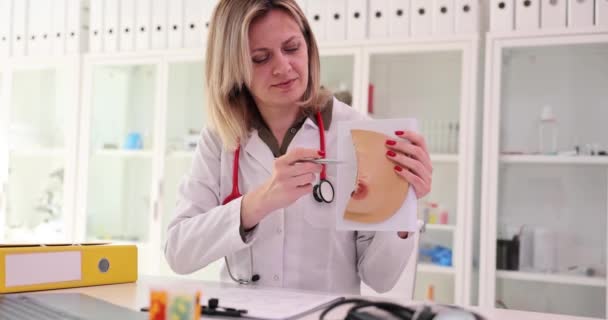 Dokter Verklaart Vrouwelijke Ziekten Kliniek Kantoor Vrouw Expert Toont Structuur — Stockvideo