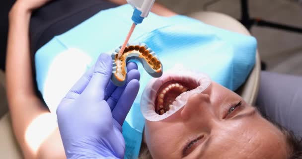 一个有牙科医生的张嘴的女人 特写镜头 城堡铸件 安装支架 慢动作 — 图库视频影像