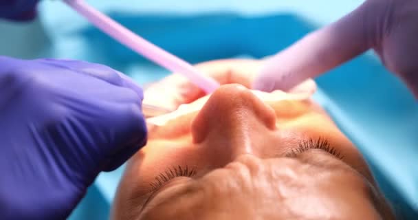 牙科医生在牙齿上放置临时填充物或安装牙龈 诊所的牙科治疗 — 图库视频影像