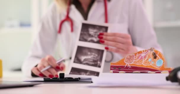 Mammoloog Onderzoekt Het Resultaat Van Mammografisch Onderzoek Van Borst Met — Stockvideo