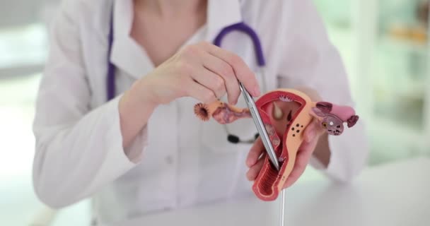 Gynekolog Förklarar Anatomi Kvinnliga Könsorgan Närbild Modell Artificiell Livmoder Kvinnors — Stockvideo