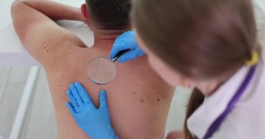 Dermatolog klinikteki doğum lekesini büyüteçle yakından inceliyor. Benlerin ve neoplazmaların dermoskopisi