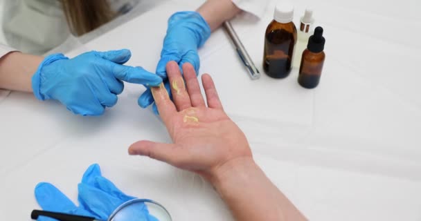 Orvos Orvosi Kesztyűben Kenőcsöt Tesz Beteg Fájó Ujjára Bőrprobléma Hámlás — Stock videók