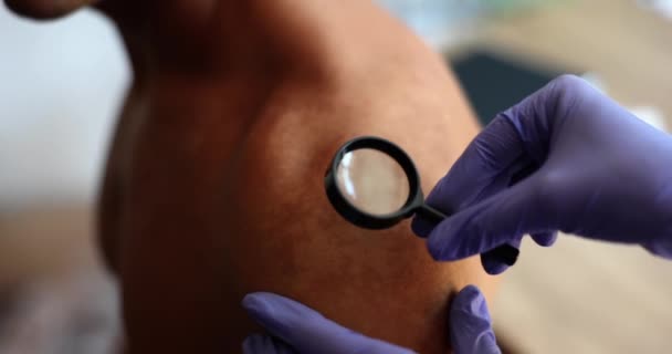 Dermatologista Examina Pele Com Manchas Paciente Closeup Clínica Queimar Alterações — Vídeo de Stock