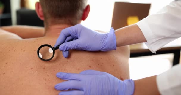Onkolog Zkoumá Novotvary Kůži Dospělého Lupou Diagnostikuje Rakovinu Kůže Hemangiom — Stock video