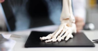 Anatomical model of the foot, part of the skeleton on the table, close-up. Diagnosis of diseases of the joints, x-ray