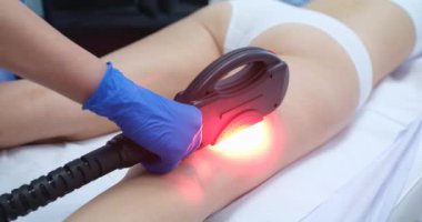 A doctor in gloves removes leg veins with a laser, close-up. Medical equipment, treatment of varicose veins