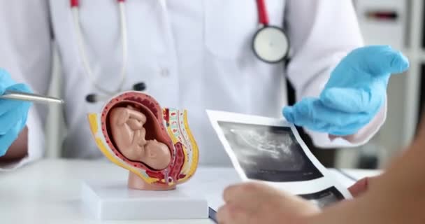 Een Gynaecoloog Toont Een Anatomisch Model Van Baarmoeder Met Een — Stockvideo