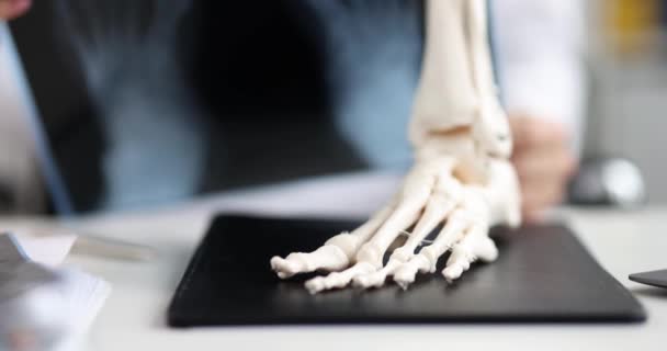 Anatomical Model Foot Part Skeleton Table Close Diagnosis Diseases Joints — Stock Video