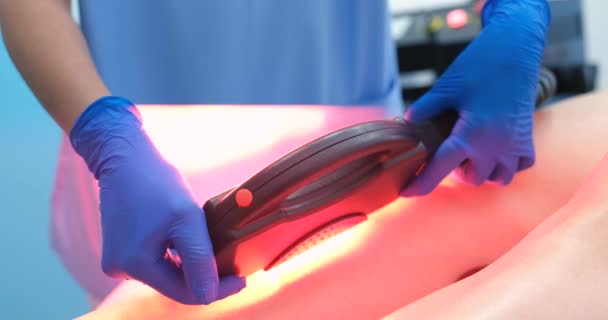 Doctor Removes Hair Legs Woman Laser Close Laser Medical Equipment — Vídeos de Stock
