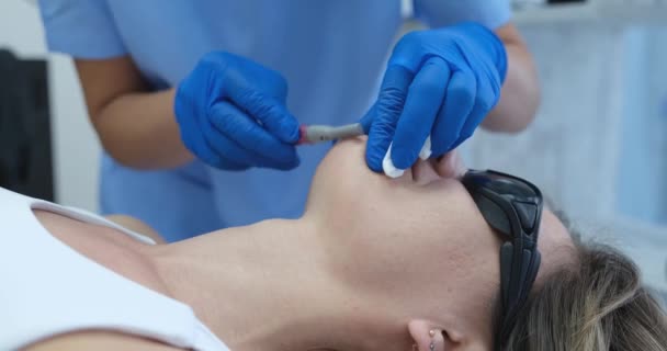 Kosmetyk Usuwa Włosy Podbródku Zbliżenie Laserowa Depilacja Salonie Zabieg Kosmetyczny — Wideo stockowe