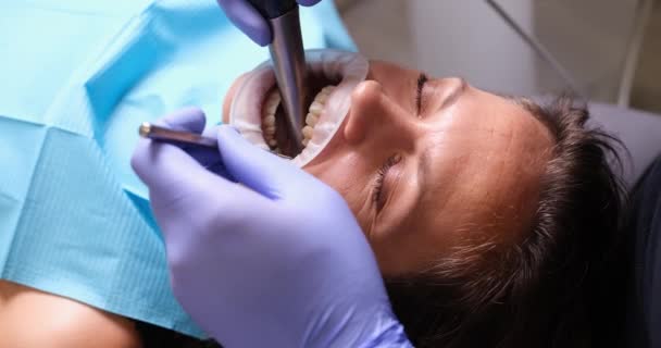Doctor Dentist Treating Teeth Female Patient Using Tools Drill Clinic — Vídeos de Stock