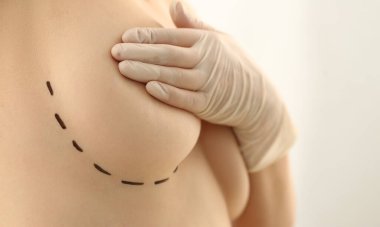 Klinikte estetik ameliyat için kadın göğsü işaretlenmiş. Kadın göğüslerini elleriyle sıhhatle ve göğüslerini gererek kapatıyor.