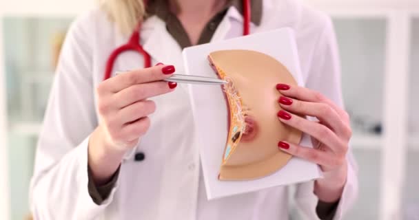 Kobieta Lekarz Wyjaśnia Choroby Przy Użyciu Anatomicznego Modelu Piersi Objawy — Wideo stockowe