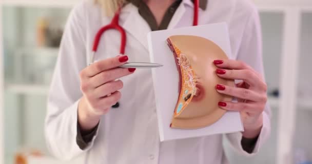 職場制服の女性医師は クリニックオフィスで女性の病気を説明します エキスパートは 影響を受ける女性の乳房の構造を示しています ペンの遅い動きを指す — ストック動画