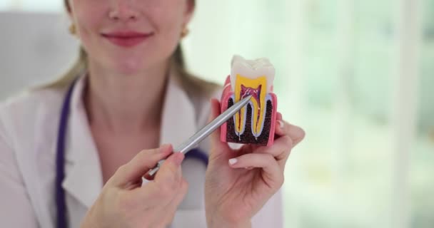 Dişçi Klinikte Yapay Diş Modelleri Gösteriyor Doktor Dişleri Ihmal Etmekten — Stok video