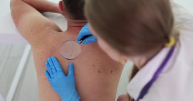 Uzman doktor, klinikte papilloma olup olmadığına bakıyor. Dermatolog, erkek hasta sırt derisi kontrolü için büyüteç kullanıyor.