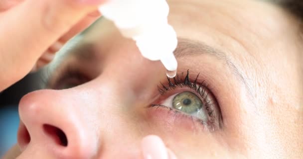 Closeup Woman Pouring Drops Red Eye Conjunctivitis Glaucoma Poor Vision — Vídeo de stock