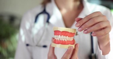Dentist shows problem areas of teeth on artificial jaw closeup. Beautiful healthy teeth and veneer installation