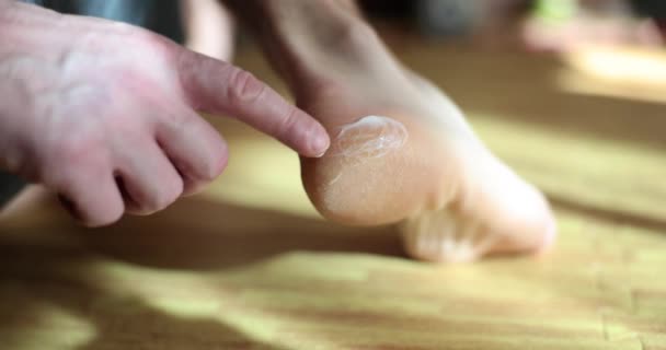 Man Hand Applies Moisturizing Nourishing Cream Heels Feet Dry Cracked — Video
