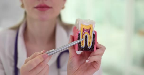 의사는 치아와 건강한 치아에 캐리어를 보여줍니다 — 비디오