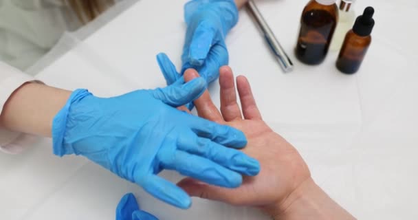Médico Para Tratamento Esfregaços Mão Paciente Com Pomada Doutor Lubrifica — Vídeo de Stock