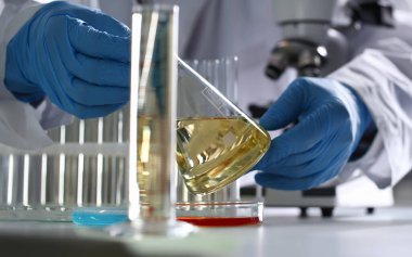 Erkek eli sarı sıvı test tüpü içinde tut. Konveyör hattı üretim ev temizlik ürünleri deterjanlar imha lekeleri zararlıları idrar zehir panzehir aşı kavramı temizleme yardım.