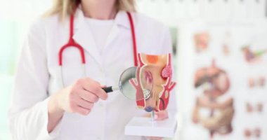 Doktor, rektumun yapay modelini elinde tutuyor. Patolojiler, problemleri büyüteçle gösteriyor. Uzman, rektal kanal yavaş çekim hastalıklarını açıklıyor