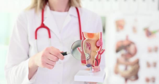 Doctor Holds Artificial Model Rectum Pathologies Pointing Magnifying Glass Problems — Stock Video