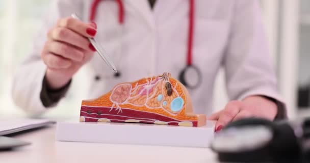 医生在医院办公室解释女性疾病 工作服专家展示了受影响胸部笔尖指向桌子慢动作的结构 — 图库视频影像