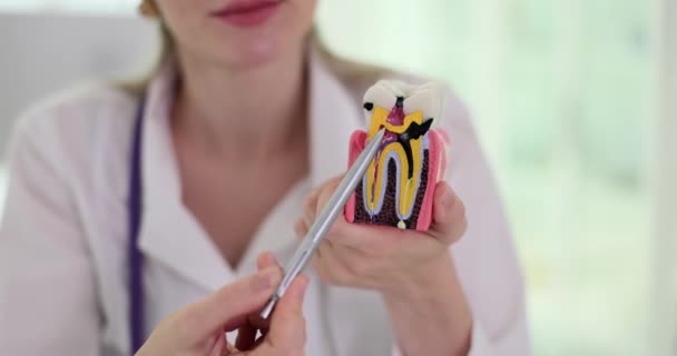 Diş Hekimi Muayene Odasında Yapay Diş Örneği Gösteriyor Doktor Dişlerin — Stok video