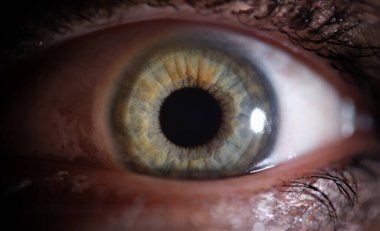 Gri tonlu güzel bir makrosu olan insan gözü. Hyperopia miyop astigmat ve lazer görme düzeltme kavramı