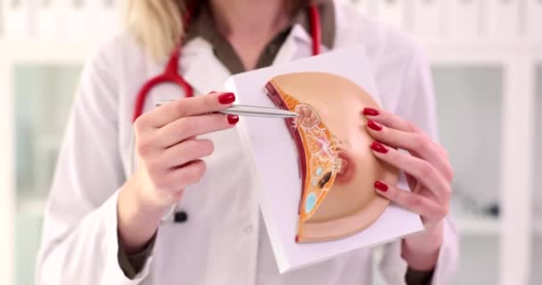 Γυναίκα Γιατρός Εξηγεί Ασθένεια Και Χρησιμοποιεί Ανατομικό Μοντέλο Του Μαστού — Αρχείο Βίντεο