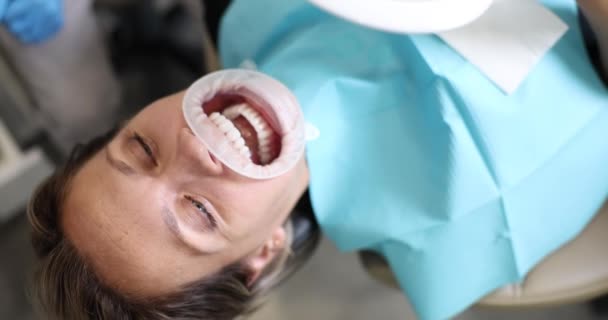 Chica Silla Dental Después Del Tratamiento Dental Espejo Blanqueamiento Dientes — Vídeos de Stock