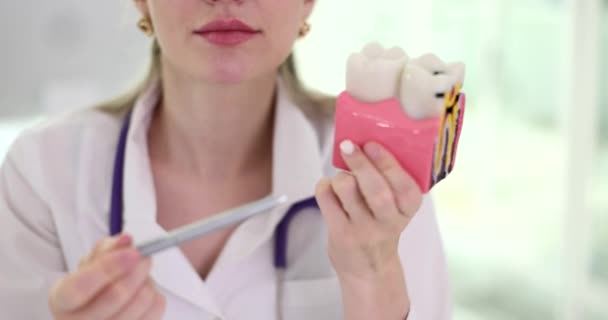 Dentysta Pokazuje Próchnicę Sztucznym Zębie Metod Leczenia Problemy Stomatologiczne Leczenie — Wideo stockowe