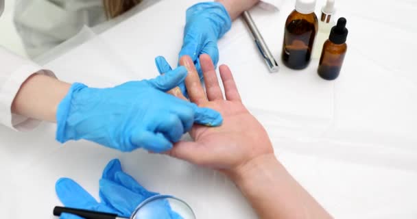 Lekarz Stosuje Maść Leczniczą Leczeniu Dłoni Pacjenta Peeling Oparzenia Skóry — Wideo stockowe