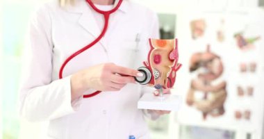 Hemoroitler için anatomik rektum modeli ve astezoskoplu bir doktor. Hemoroit teşhisi ve tedavisi