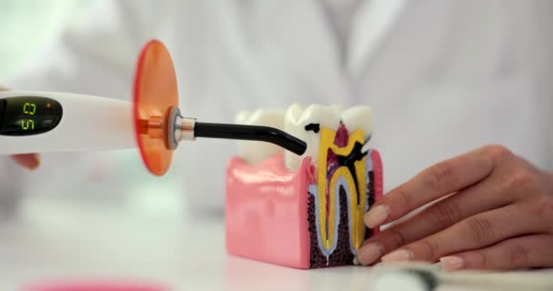 Lámpara Fotopolímero Dentista Con Lámpara Azul Luminosa Dentista Trata Prótesis — Vídeo de stock