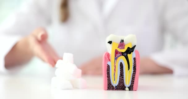 Kunststof Tand Met Cariës Met Suikerkliniek Begrip Cariës Suiker Tandverzorging — Stockvideo