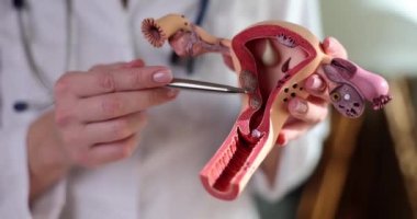 Doktor rahmin ve yumurtalıkların modelini tutuyor. Yumurtalık ve rahim ağzı kanseri ve rahim ağzı rahatsızlığı