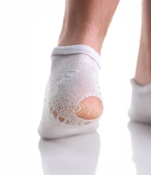 Zerrissene Weiße Socke Bein Des Mannes Isoliert Ein Mann Verlor — Stockfoto