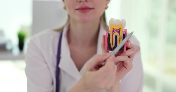 Dentysta Pokazuje Próchnicę Sztucznym Zębie Metod Leczenia Problem Stomatologiczny Koncepcja — Wideo stockowe