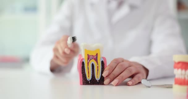Médico Mostra Modelo Dente Artificial Escova Dentes Para Prevenção Cárie — Vídeo de Stock